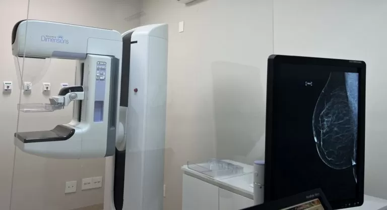 São Vicente Cidade dos Lagos atende pacientes de Prudentópolis com mutirão de mamografia
